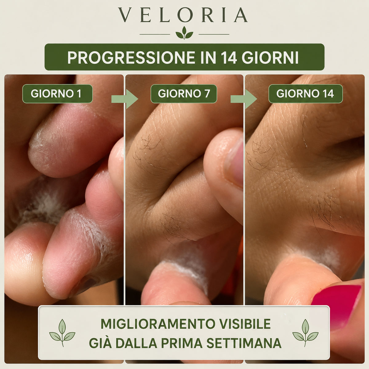 Sapone Anti-Micosi VELORIA